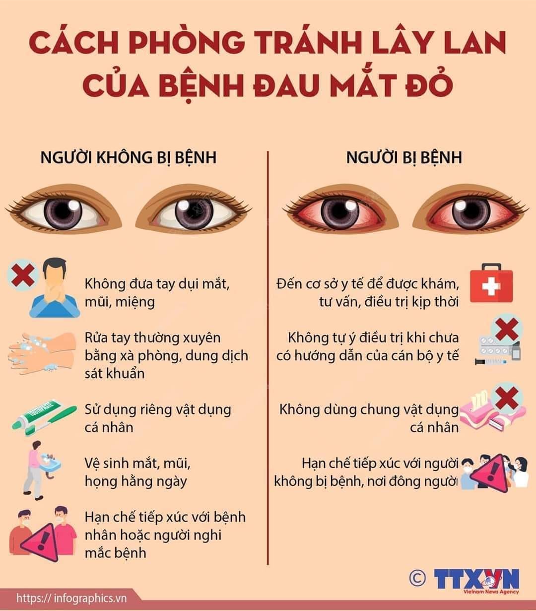 Cách phòng chống dịch đau mắt đỏ